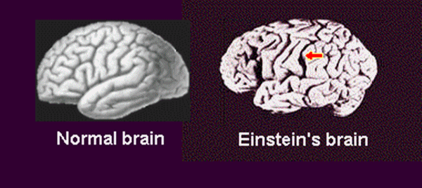 Sự thật nằm sau bộ não thiên tài của Albert Einstein