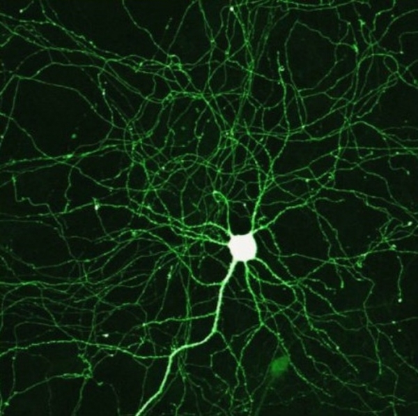 Một lý thuyết đã lỗi thời trong y học về tế bào thần kinh