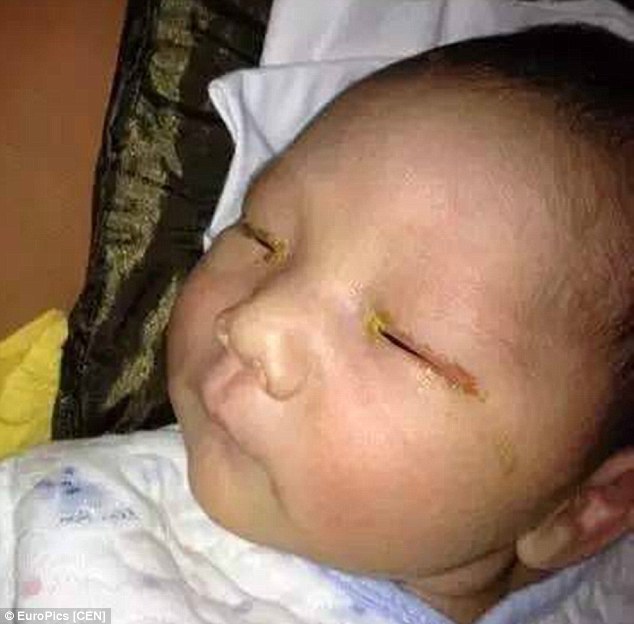 
Một cậu bé Trung Quốc bị mù sau khi chụp ảnh với đèn flash, liệu đó có phải là nguyên nhân?
