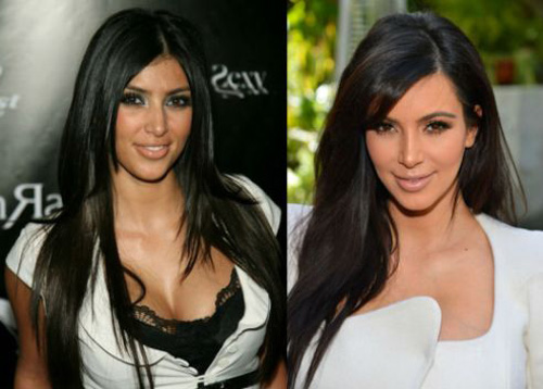  Kim Kardashian - Ngôi sao truyền hình thực tế nổi tiếng nhờ dao kéo 