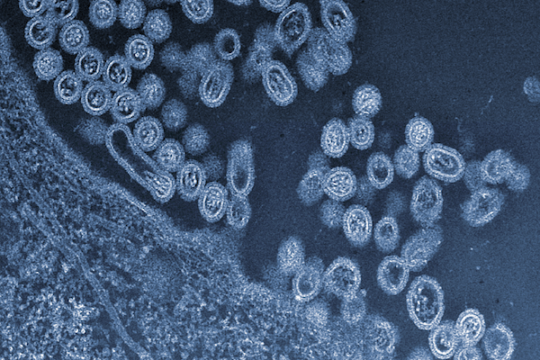 Các virus được biến đổi thành vắc-xin nhờ axit amin nhân tạo 