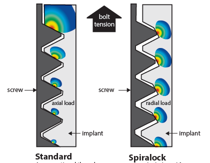 
So sánh giữa ren vít thông thường và ren vít Spiralock.
