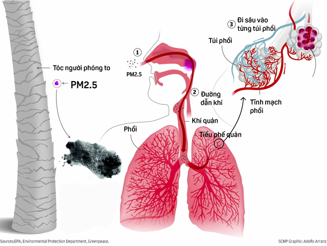 Bụi PM2.5 có thể thẩm thấu vào máu thông qua đường hít thở 