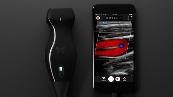  Butterfly IQ được kết nối với iPhone với khả năng siêu âm cơ thể người dùng. 