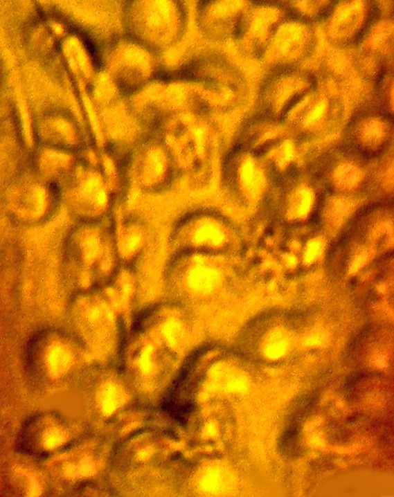 Một mảnh nhỏ của miếng hổ phách có chứa các tế bào hồng cầu