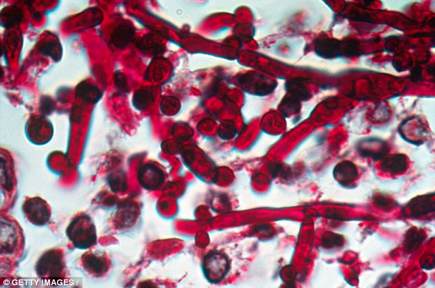  Được gọi là Candida auris, chủng nấm này kháng thuốc rất mạnh và có khả năng gây ra nhiễm trùng máu dẫn đến tử vong 