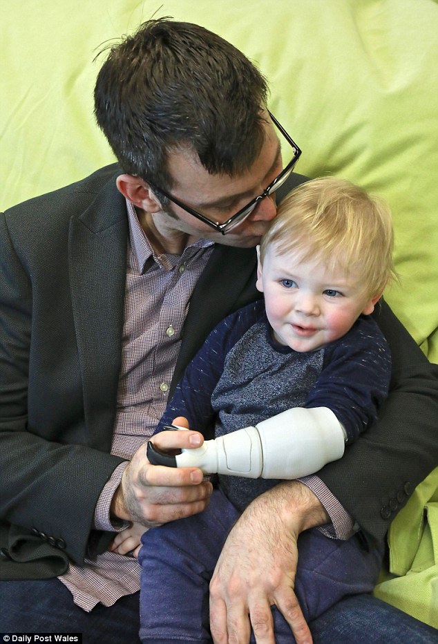  Ryan và con trai mình, cậu bé Sol bị mất cánh tay trái khi mới 10 ngày tuổi 