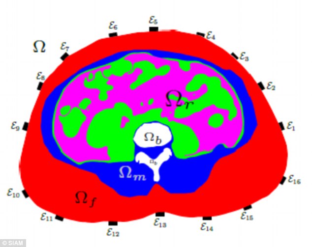  Hình ảnh chụp EiT: Màu đỏ đại diện cho mỡ bụng, màu xanh là cơ bắp, xương màu trắng, màu hồng là vùng nội tạng, và màu xanh lá cây thể hiện các cơ quan 