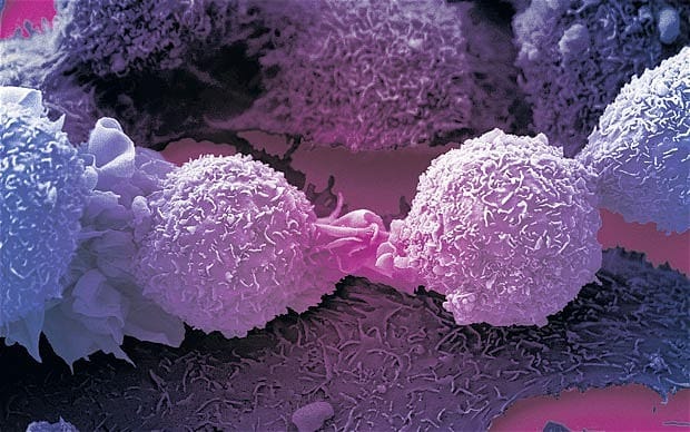  Tế bào ung thư rất láu cá, chúng giả vờ nhiễm virus để tự mạnh lên và kháng thuốc điều trị 