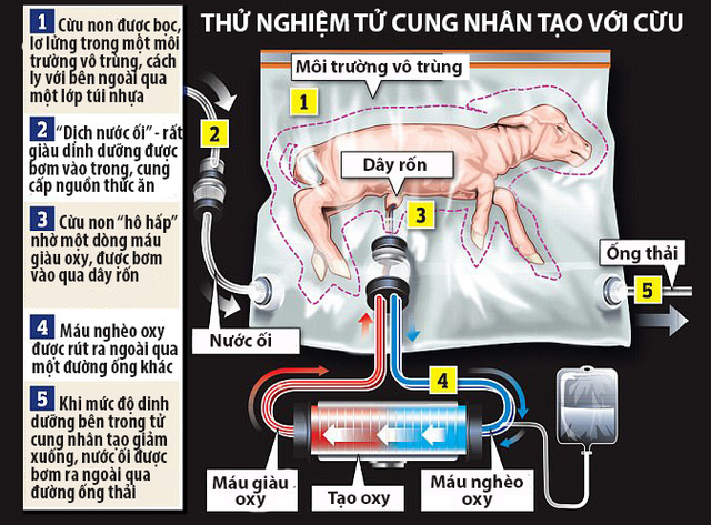  Tử cung nhân tạo bắt chước đầy đủ môi trường bên trong một tử cung thật 