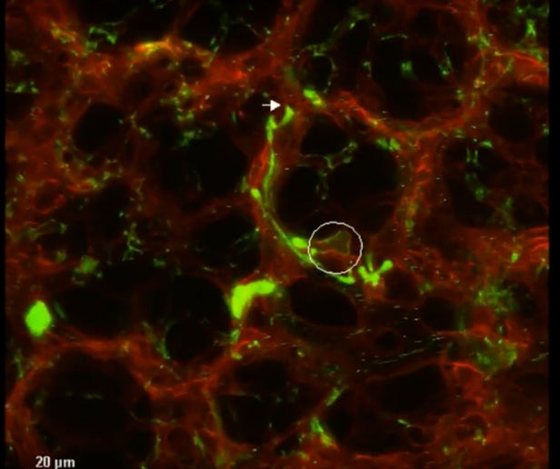  Hơn một nửa tế bào tiểu cầu trong chuột có thể được sinh ra từ đây, phổi của chúng 
