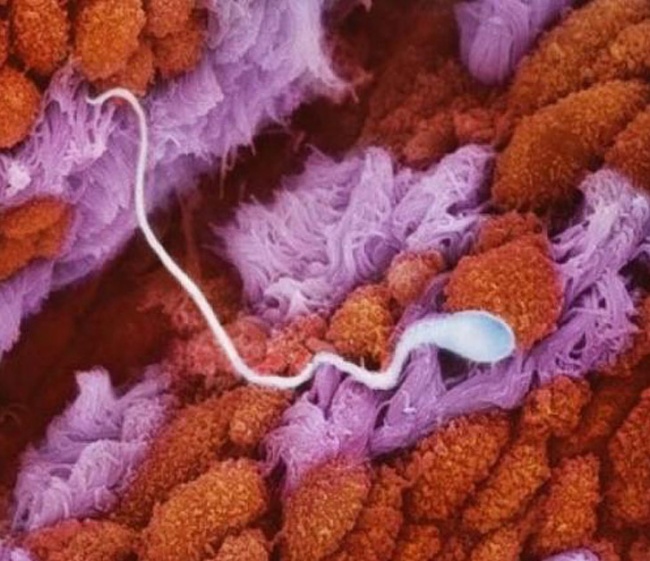  Tinh trùng di chuyển dọc theo ống dẫn trứng 