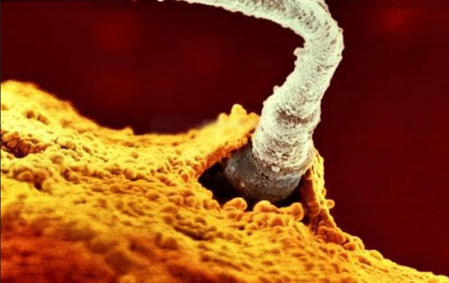  Một trong 200 triệu tinh trùng đang xâm nhập màng tế bào trứng 