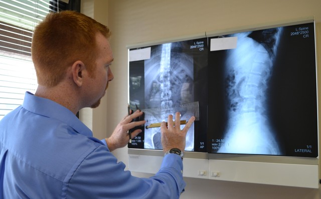 Tia X được ứng dụng để chụp xương.