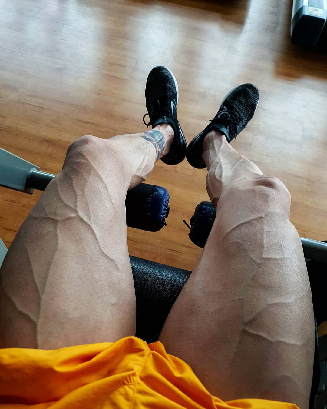 Một số người có làn da nổi gân guốc nhiều hơn hẳn phần còn lại và đây là lý do - Ảnh 3. Một số người có làn da nổi gân guốc nhiều hơn hẳn phần còn lại và đây là lý do - Ảnh 3.