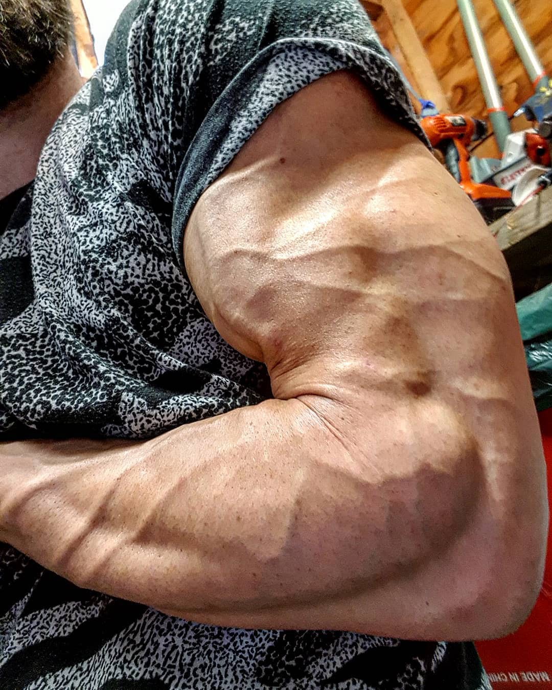 Một số người có làn da nổi gân guốc nhiều hơn hẳn phần còn lại và đây là lý do - Ảnh 4. Một số người có làn da nổi gân guốc nhiều hơn hẳn phần còn lại và đây là lý do - Ảnh 4.