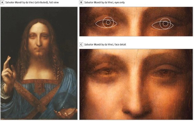 Leonardo da Vinci trở thành danh họa vĩ đại vì mang tật lác mắt hiếm gặp? - Ảnh 1.