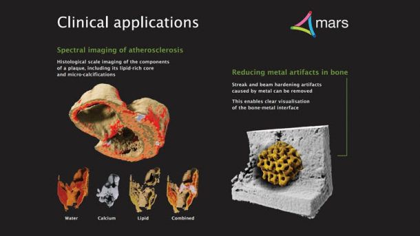 Chiếc máy X-ray độc đáo này có thể tạo hình ảnh 3D cơ thể người - Ảnh 2.