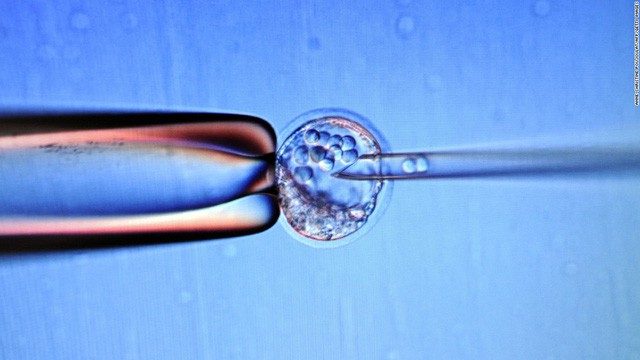  Liệu pháp tế bào gốc đang là hi vọng của các bệnh nhân thoái hóa hoàng điểm 