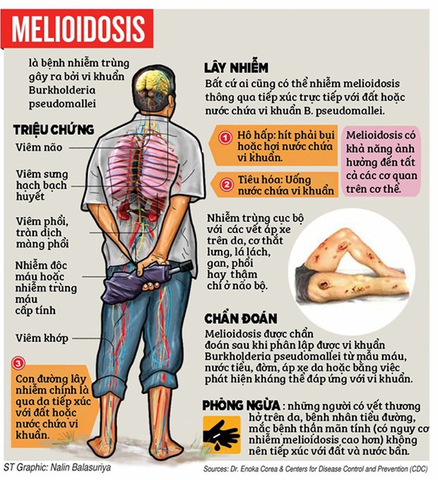 Căn bệnh giết người bị lãng quên: Đôi chân đất của người nông dân và siêu vi khuẩn dưới bùn ruộng - Ảnh 12.