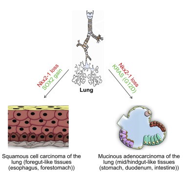  Con đường biến hình của các tế bào ung thư phổi 