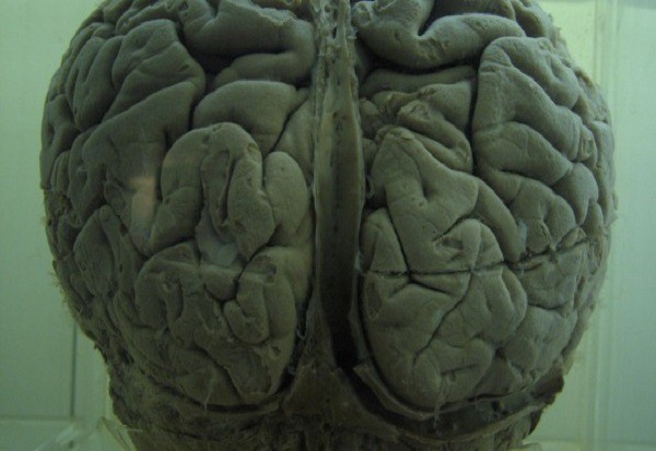 Nếu các nhà khoa học tạo ra được một bộ não, liệu nó sẽ có linh hồn người? - Ảnh 4.