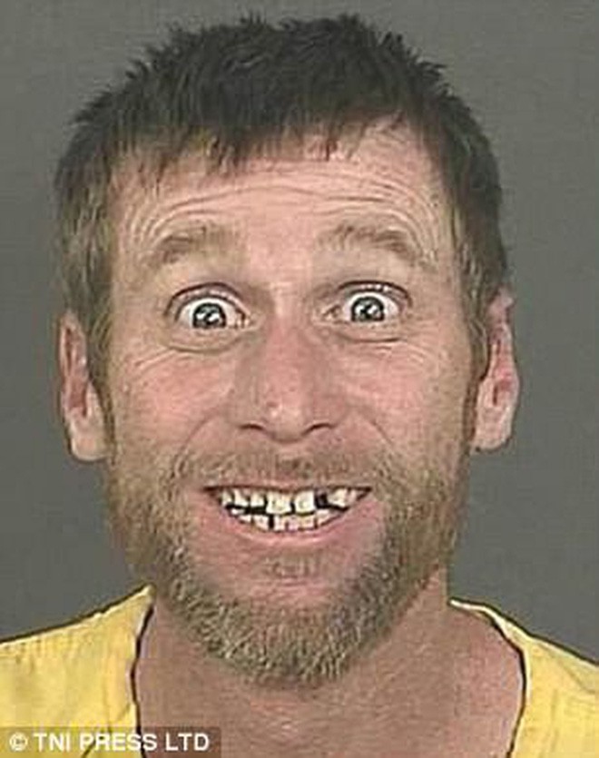 Những tấm ảnh xộ khám hài hước của tù nhân Mỹ: kẻ chỉ có 3 răng, người thì nhìn y chang con lười trong phim Ice Age - Ảnh 1.
