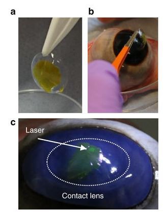 Các nhà khoa học chế tạo thành công kính áp tròng với khả năng tự phóng ra tia laser - Ảnh 1.