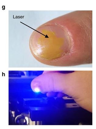 Các nhà khoa học chế tạo thành công kính áp tròng với khả năng tự phóng ra tia laser - Ảnh 2.