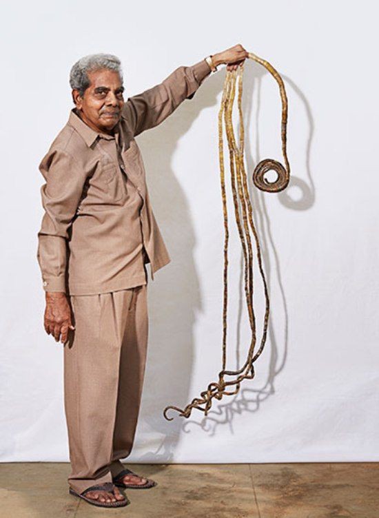 Sau 66 năm ròng khổ sở gìn giữ, người đàn ông này đã cắt đi bộ móng tay đạt kỷ lục Guinness của mình - Ảnh 1.