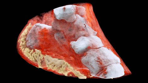 Đây là hình ảnh X-quang màu 3D đầu tiên trên thế giới, đừng xem nếu bạn yếu tim - Ảnh 2.