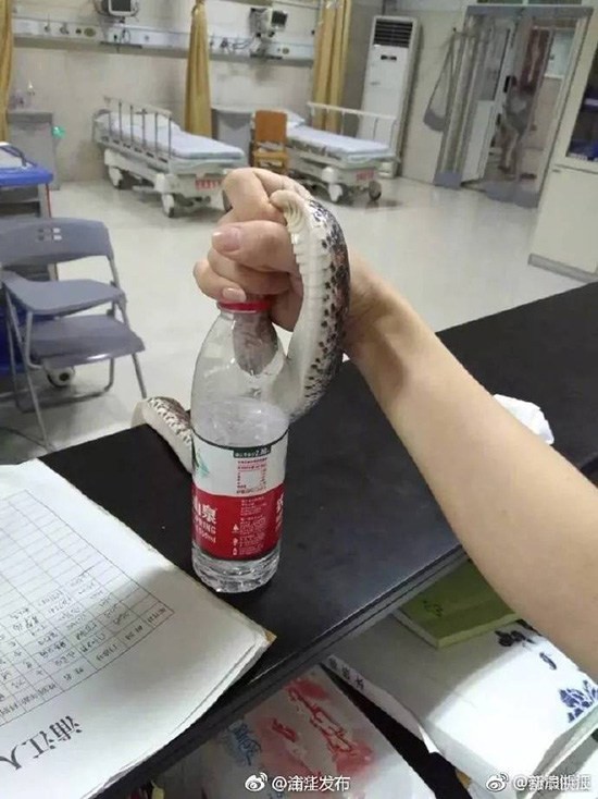 Trung Quốc: Bị cắn nhưng không biết là rắn gì, cô gái bình tĩnh túm cổ nó mang đến bệnh viện - Ảnh 2.
