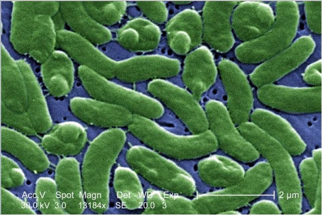 Những điều bạn chưa biết về vi khuẩn ăn thịt người - Ảnh 4.
