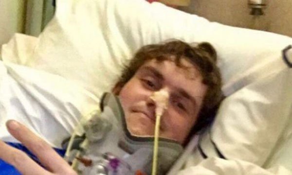 Chàng trai 22 tuổi gây chấn động y học vì sống sót sau tai nạn suýt rụng đầu - Ảnh 2.
