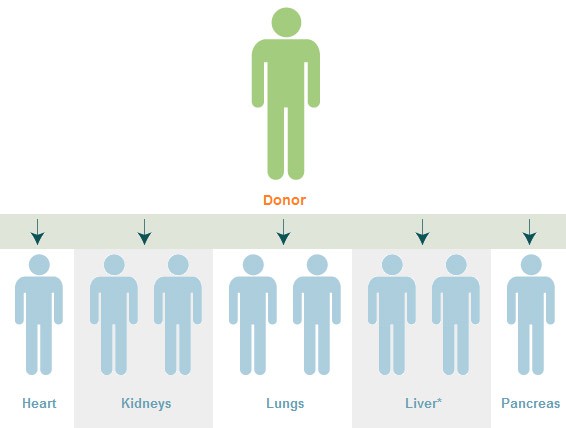 Trường hợp y tế chưa từng có: 4 bệnh nhân lây ung thư sau khi nhận tạng ghép từ cùng một người - Ảnh 2.