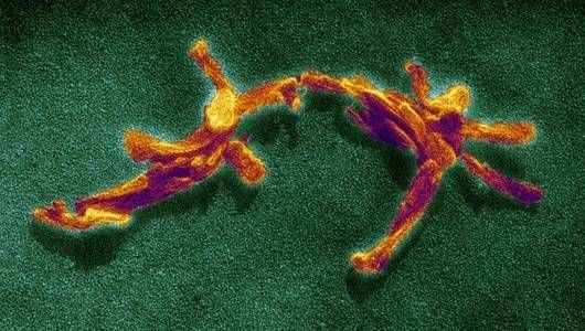 Nguy hiểm hơn Ebola, những người nhiễm bệnh sẽ cười điên loạn như Joker rồi chết - Ảnh 9.