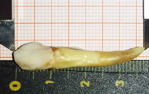 Người đàn ông đi vào Sách kỷ lục Guiness vì sở hữu chiếc răng dài gần 4cm - Ảnh 2.