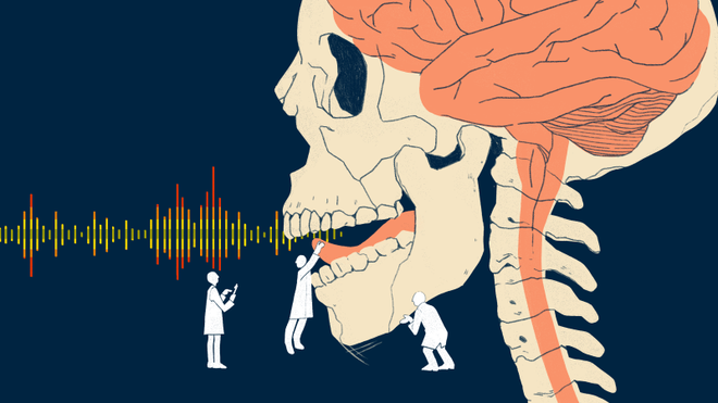 Các nhà khoa học đã có thể mô phỏng giọng nói bằng tín hiệu não - Ảnh 1.
