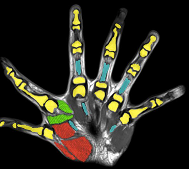 Các nhà khoa học phát hiện rằng việc có sáu ngón tay có thể đem lại nhiều lợi ích trong cuộc sống - Ảnh 2.