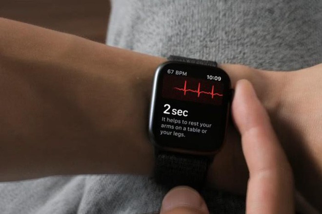 Bác sĩ người Anh cho rằng quá tin vào điện tâm đồ trên Apple Watch có thể gây hại nhiều hơn lợi - Ảnh 2.
