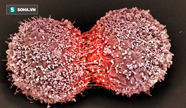 Những thực phẩm thúc đẩy tế bào ung thư: PCT Hội Ung thư HN khuyên người bệnh tránh xa - Ảnh 1.