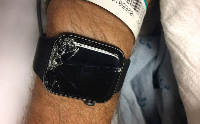 Nhờ đeo Apple Watch, cụ ông tại Mỹ may mắn được cứu sống khi bị chấn thương sọ não do ngã xe - Ảnh 2.