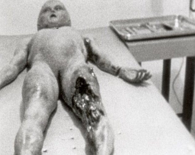 Roswell, New Mexico sprang to international fame on July 8, 1947, when the local newspaper reported the capture of a flying saucer by government officials in the town. The original Roswell hoax alien autopsy pictures, including this one, were unveiled in 1995