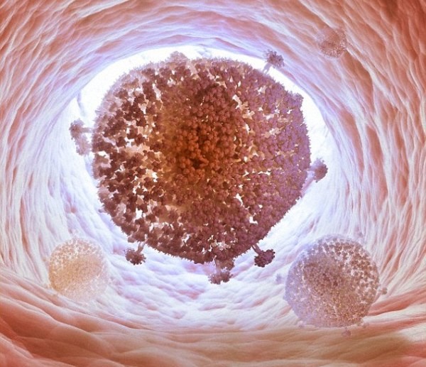 Xóa sổ thành công virus HIV khỏi tế bào con người?