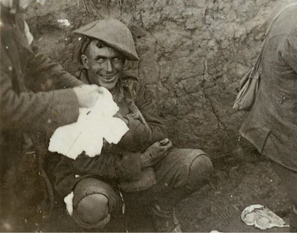  &nbsp;Đôi mắt điên dại- Người chiến binh này bị sốc do bom đạn nổ liên tiếp gây chấn thương thần kinh dẫn đến mất trí, mất ngủ, mất khả năng nói chuyện hay đi lại. Bức ảnh được chụp vào năm 1916 trong Chiến dịch Courcelette, Pháp. 