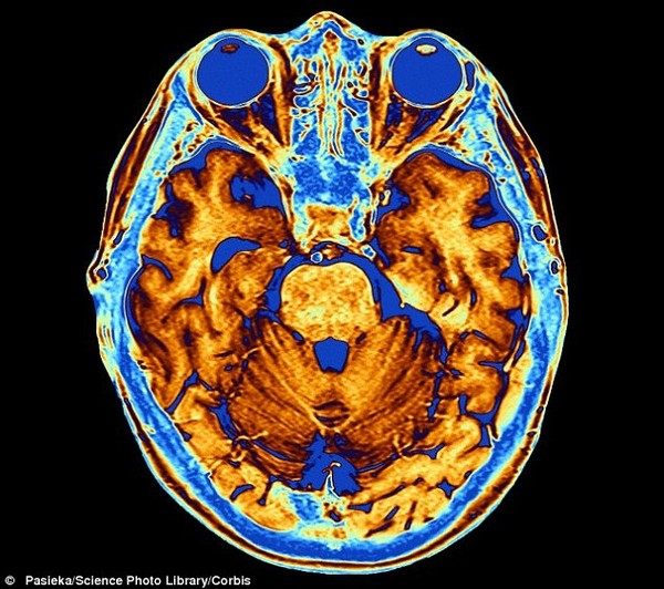 
Phương pháp chụp cộng hưởng từ (MRI)
