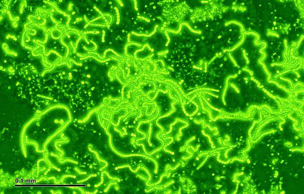 Hình ảnh khuẩn lam dưới kính hiển vi