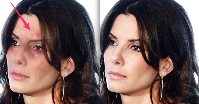 Ảnh Sandra Bullock bị chỉnh sửa (bên trái). Ảnh Sandra Bullock bị chỉnh sửa (bên trái).