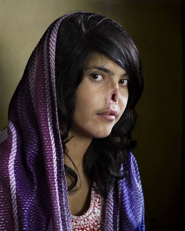  Đôi mắt của lòng dũng cảm- Cô gái Bibi Asha, 18 tuổi bị cha mình gả cho một tay súng Taliban khi chỉ mới 14 tuổi để đền bù cho tội giết người của một thành viên trong gia đình. Trong vòng 4 năm cố gắng trốn chạy, Asha đã phải trải qua nhiều sự hành hạ tra tấn, sau đó bị cảnh sát bắt lại và trao trả cho gia đình nhà chồng. Cha chồng, chồng và 3 thành viên nhà chồng khác đã trừng phạt cô gái bằng cách cắt mũi, cắt tai, để mặc Asha đến chết. Sau đó Asha được giải cứu bởi nhân viên cứu hộ và quân đội Mỹ. 