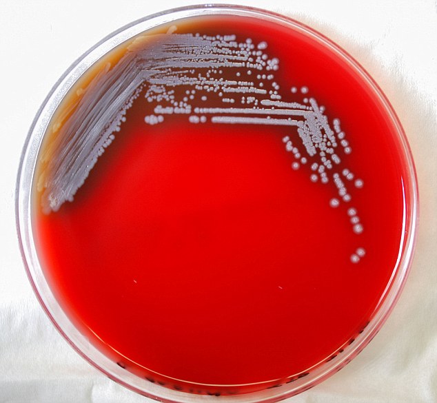 Burkholderia pseudomallei, siêu vi khuẩn có mặt ở Việt Nam, có thể giết chết bạn trong vòng 2 ngày 